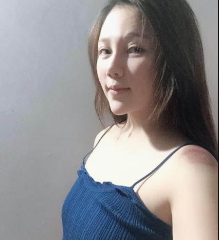 北京東方和諧醫(yī)療整形診所馮斌醫(yī)生做假體隆胸怎么樣？附案例效果對比圖
