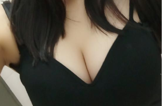 武漢伽美醫(yī)療美容醫(yī)院醫(yī)生朱富初做自體脂肪隆胸怎么樣？看案例
