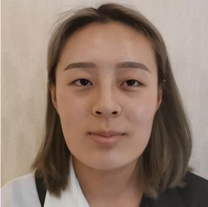 上海時(shí)光整形醫(yī)院做雙眼皮怎么樣？附石重明醫(yī)生雙眼皮+隆鼻+下頜角磨骨案例效果對(duì)比圖