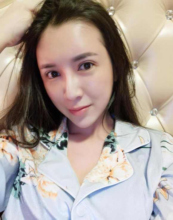 上海時(shí)光整形醫(yī)院張晶醫(yī)生做開眼角怎么樣？附真實(shí)效果圖
