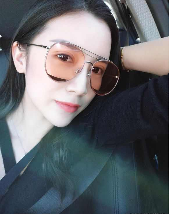 上海時(shí)光整形醫(yī)院張晶醫(yī)生做開眼角怎么樣？附真實(shí)效果圖