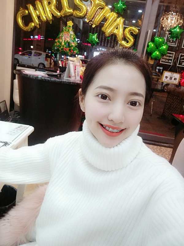 巴中華醫(yī)口腔醫(yī)院做牙齒矯正效果好嗎？附母汶靈醫(yī)生牙齒矯正案例效果圖
