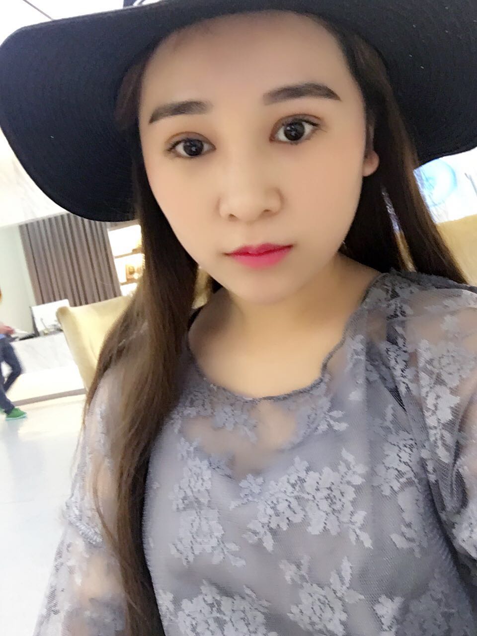 蚌埠韓美美萊整形醫(yī)生鄭捷做開眼角怎么樣？附案例效果圖