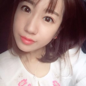 蚌埠韓美美萊整形做玻尿酸面部除皺效果怎么樣？附陳澤醫(yī)生案例效果圖