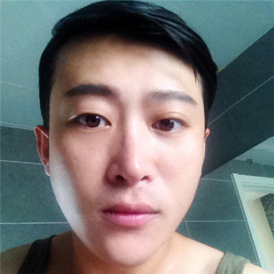 安陽上城醫(yī)療整形醫(yī)生張少如打水光針效果怎么樣？附案例效果圖
