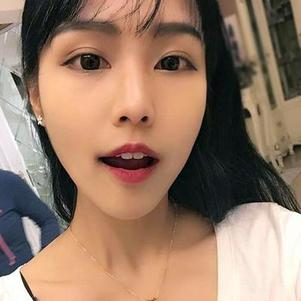 鞍山時(shí)代口腔門診部洗牙效果怎么樣？附申元休醫(yī)生洗牙案例效果圖