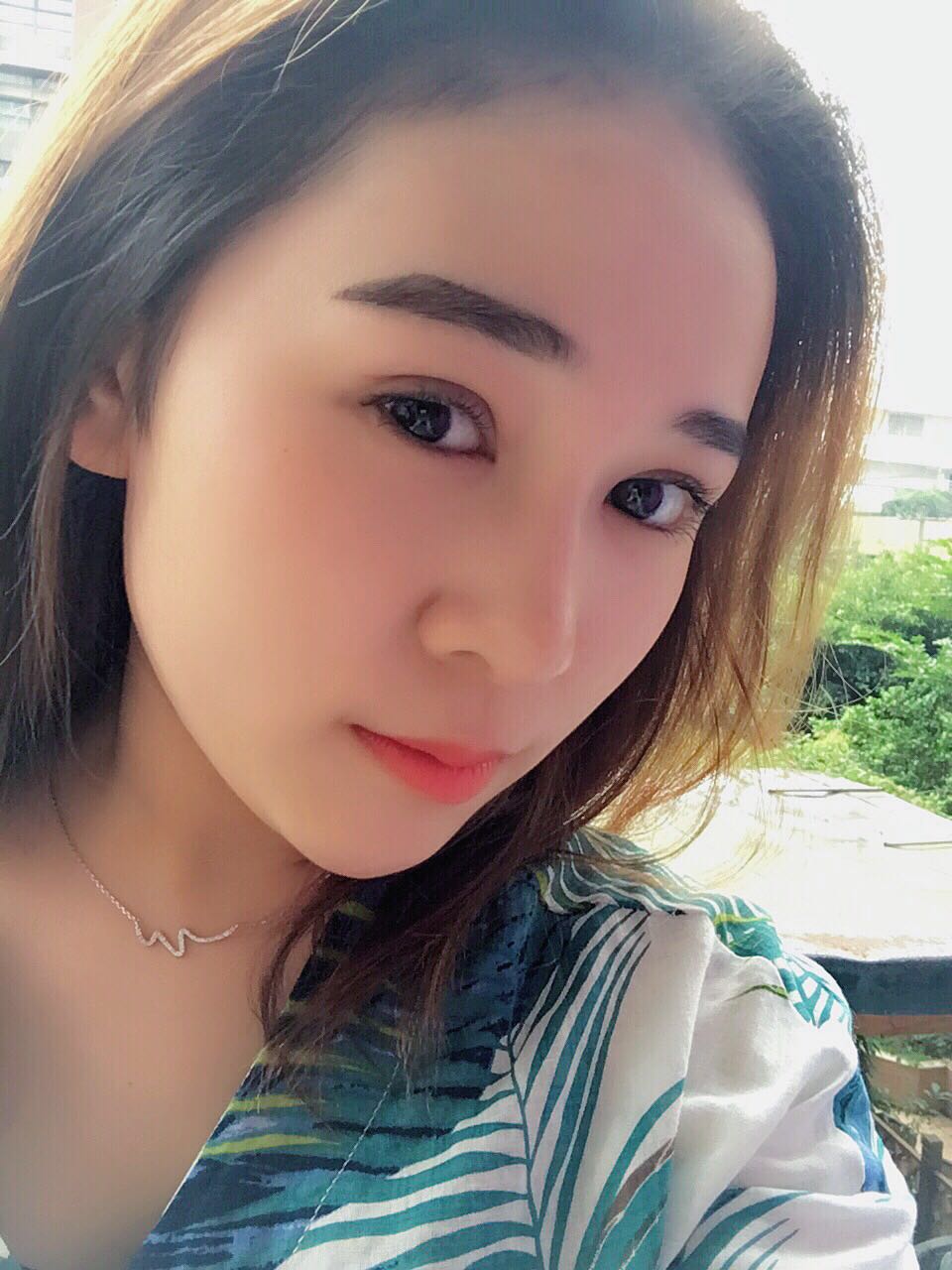 蚌埠韓美美萊整形醫(yī)生鄭捷做開眼角怎么樣？附案例效果圖