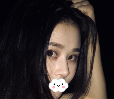蚌埠韓美美萊整形醫(yī)生歷芳做耳軟骨隆鼻怎么樣？附耳軟骨隆鼻案例對(duì)比圖