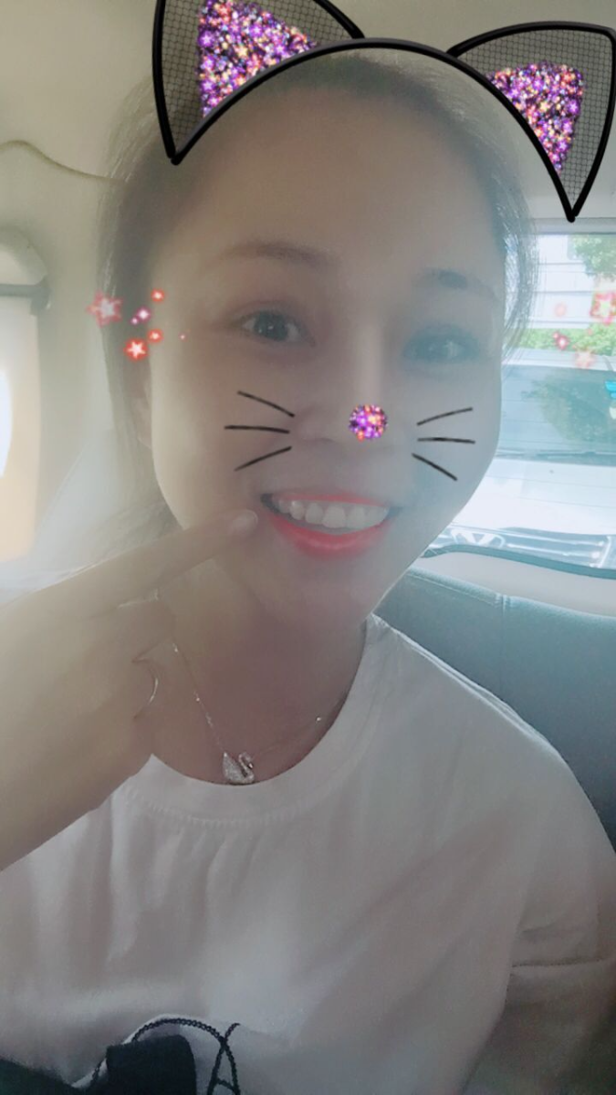 保定東陽口腔醫(yī)院趙星醫(yī)生做牙齒瓷貼面怎么樣？附牙齒瓷貼面案例效果對比圖