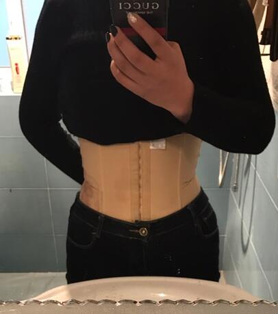 保定現(xiàn)代女子醫(yī)院整形美容中心做腰腹部吸脂怎么樣？附林秀蓮醫(yī)生案例效果圖