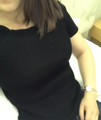 保定現(xiàn)代女子醫(yī)院整形美容中心做腰腹部吸脂怎么樣？附林秀蓮醫(yī)生案例效果圖