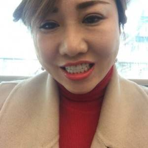 保定東陽口腔醫(yī)院趙晨醫(yī)生做瓷貼面怎么樣？附瓷貼面案例效果對比圖