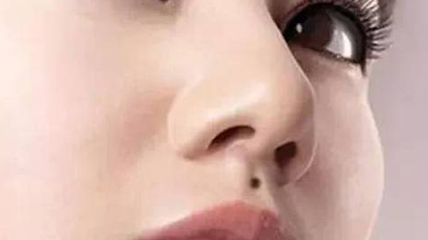 綜合隆鼻價(jià)格需要多少錢？價(jià)格貴嗎？