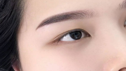 下眼瞼手術(shù)要多久時(shí)間恢復(fù)？一般需要多少錢？