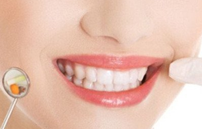 合金烤瓷牙多少錢一個(gè)？?jī)r(jià)錢貴不貴？