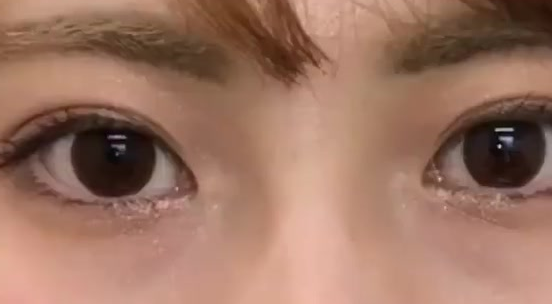雙眼皮埋線后還可以開眼角嗎？做埋線雙眼皮有什么危險？