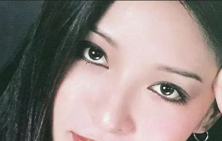 割雙眼皮會(huì)反彈嗎？