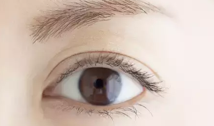 做雙眼皮的效果如何？