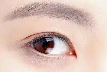 開眼角的副作用有哪些？開眼角的風(fēng)險有多大？