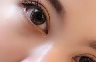 開眼角有沒有風(fēng)險(xiǎn)？開眼角有沒有副作用？