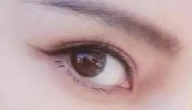開眼角需要多久才能恢復？