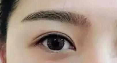 西安割雙眼皮效果好的醫(yī)院有哪幾家？人氣前六盤點(diǎn)！