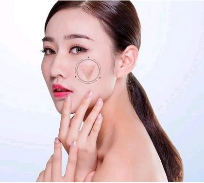 深圳好的祛痘整形醫(yī)院有哪家？名單值得收藏！