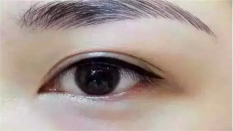 昆山雙眼皮整形醫(yī)院哪幾家好？實(shí)力口碑醫(yī)院推薦！