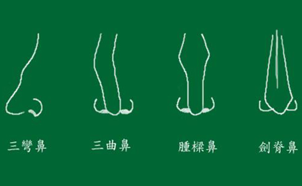 彎鼻矯正術后如何護理？要注意些什么？