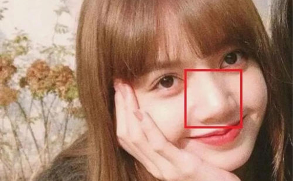 鼻子太大怎么辦？怎么改善大鼻頭