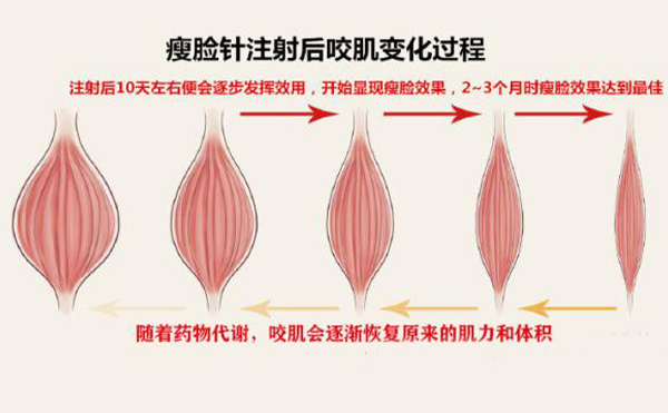 打瘦臉針打多少單位？