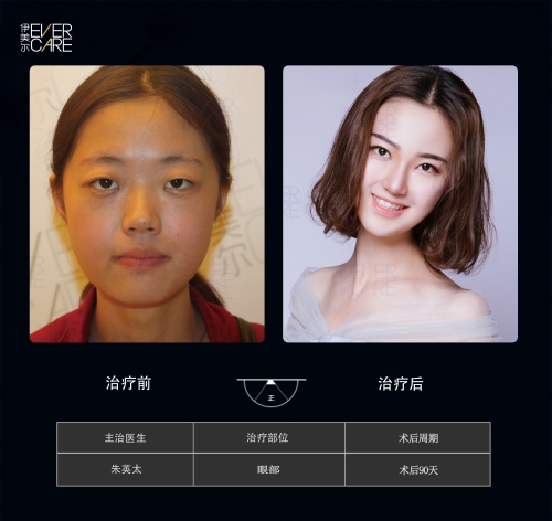 醫(yī)美整容