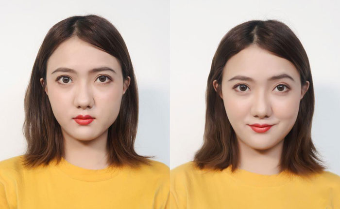 大小臉是什么原因造成的？大小臉怎么辦怎么矯正？