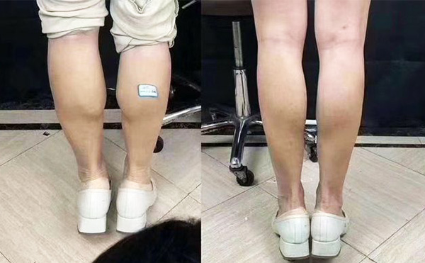 boxo瘦腿好嗎？
