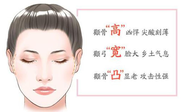 顴骨內(nèi)推整形適宜人群？