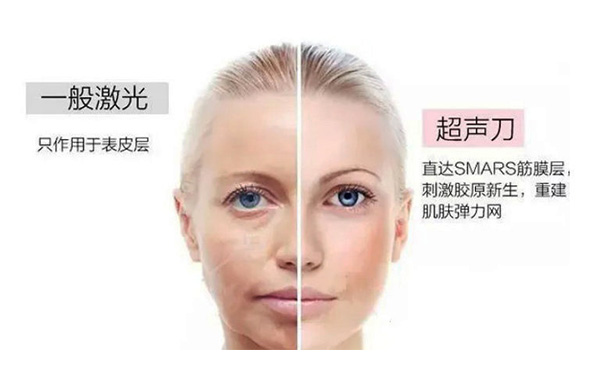 超聲刀有什么優(yōu)勢(shì)？