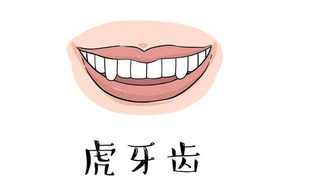虎牙矯正需要多久？