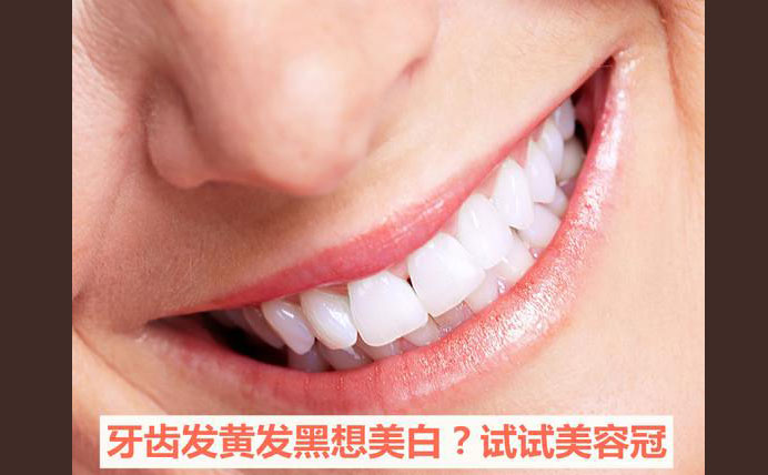 牙齒美容冠大約多少錢？牙齒美容冠怎么做的？