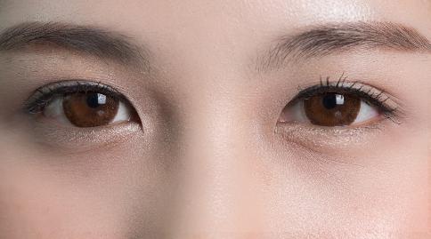 上眼皮松弛是什么原因引起的？