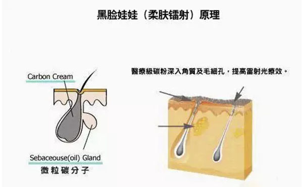 黑臉娃娃是什么？