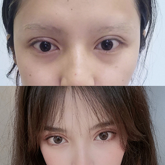 單眼皮睫毛