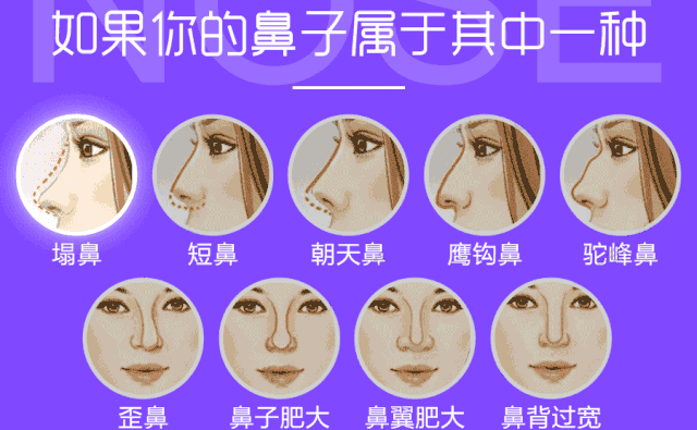 自體脂肪隆鼻可以保持多久？