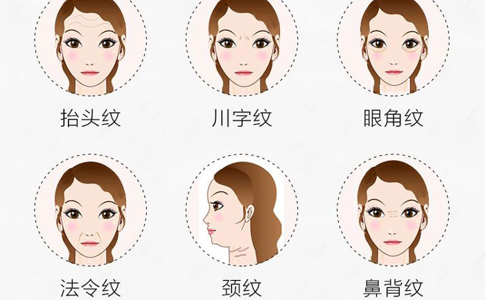 botox除皺針有哪些副作用？