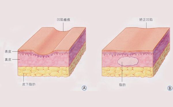 http://www.sqhhht.com.cn/news/377.html