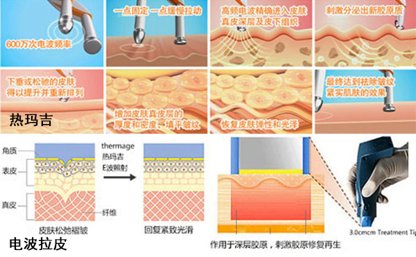 http://www.sqhhht.com.cn/news/959.html