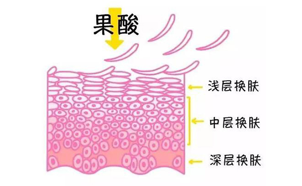 果酸煥膚的作用有哪些？