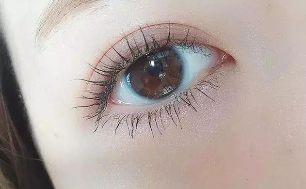 激光雙眼皮手術(shù)多少錢？激光雙眼皮手術(shù)需要多久恢復(fù)時間？