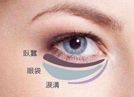 眼袋失敗修復要怎么處理？切眼袋需要多長時間恢復？