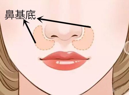 做玻尿酸墊鼻基底風(fēng)險有哪些？深圳市玻尿酸豐鼻基底大概需要費用？
