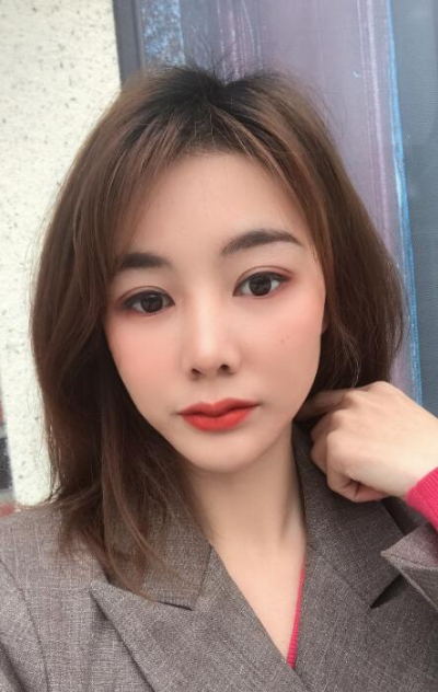  廈門(mén)華美名媛整形美容醫(yī)院俞積貴雙眼皮案例效果分享